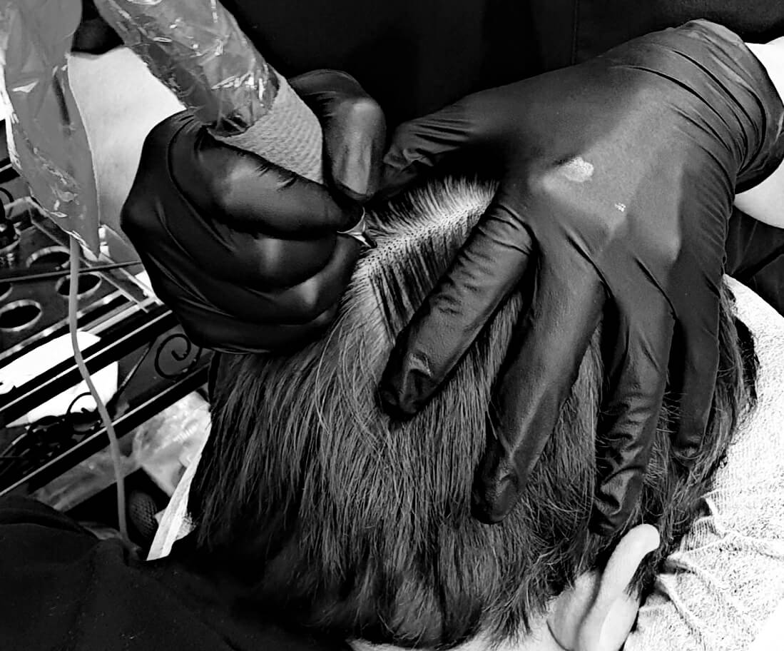 What Is Scalp Micropigmentation? A Complete Guide for Beginners